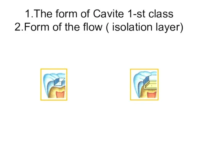 1.The form of Cavite 1-st class 2.Form of the flow ( isolation layer)