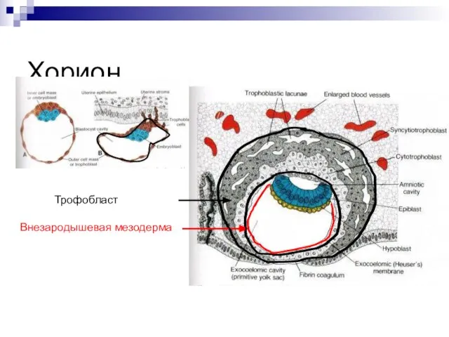 Хорион Трофобласт Внезародышевая мезодерма