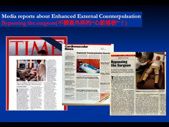 Media reports about Enhanced External Counterpulsation Bypassing the surgeon(不需要外科的“心脏搭桥”！)