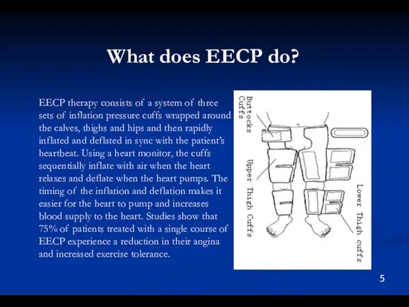 EECP therapy consists of a system of three sets of inflation pressure