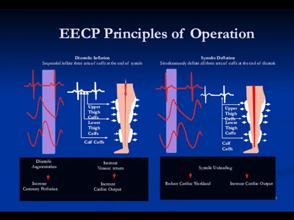 EECP Principles of Operation Systolic Deflation Simultaneously deflate all three sets of