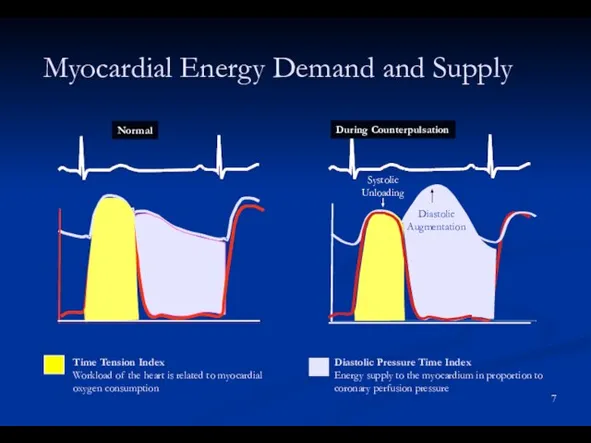 Myocardial Energy Demand and Supply Time Tension Index Workload of the heart