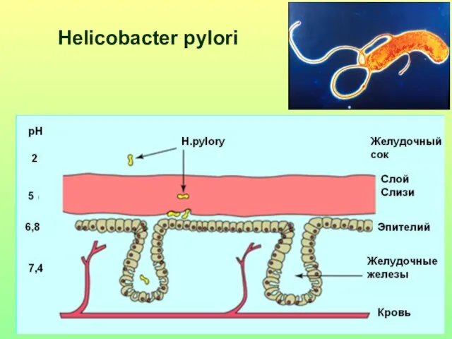 Helicobacter pylori