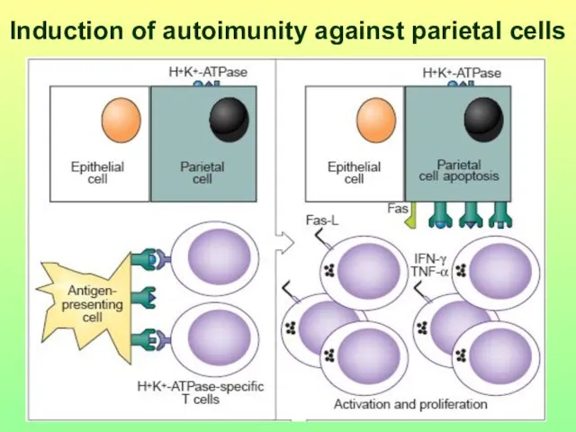 Induction of autoimunity against parietal cells