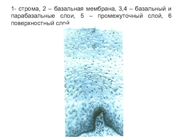 1- строма, 2 – базальная мембрана, 3,4 – базальный и парабазальные слои,