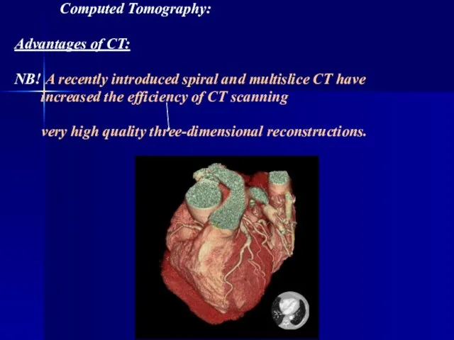 Computed Tomography: Advantages of CT: NB! A recently introduced spiral and multislice