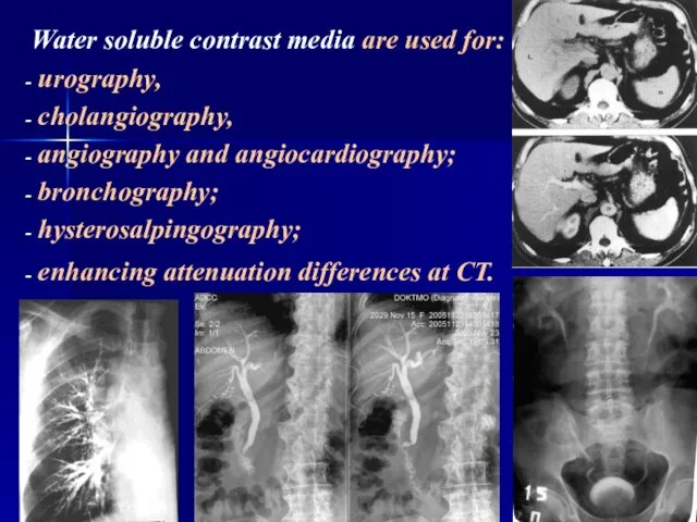 Water soluble contrast media are used for: urography, cholangiography, angiography and angiocardiography;