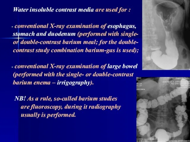 Water insoluble contrast media are used for : conventional X-ray examination of