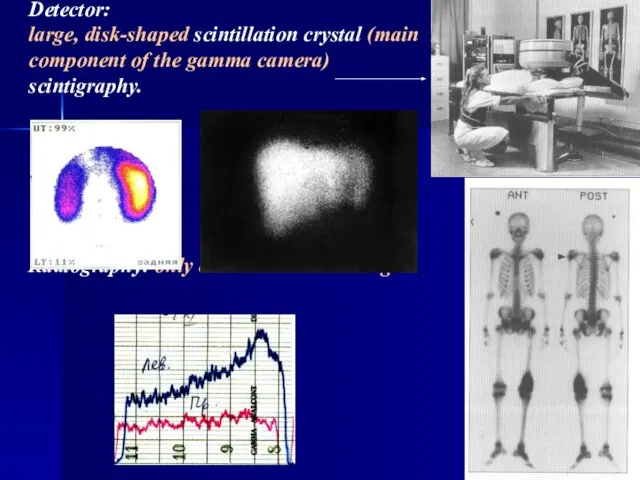 Detector: large, disk-shaped scintillation crystal (main component of the gamma camera) scintigraphy.