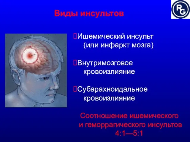 Виды инсультов Ишемический инсульт (или инфаркт мозга) Внутримозговое кровоизлияние Субарахноидальное кровоизлияние Соотношение