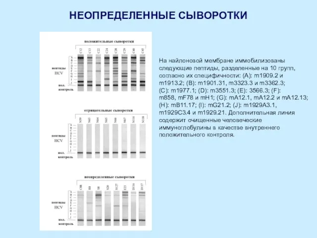 НЕОПРЕДЕЛЕННЫЕ СЫВОРОТКИ На найлоновой мембране иммобилизованы следующие пептиды, разделенные на 10 групп,