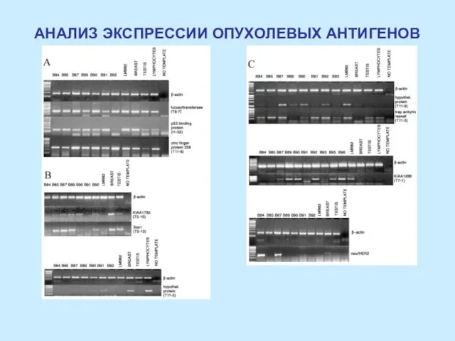 АНАЛИЗ ЭКСПРЕССИИ ОПУХОЛЕВЫХ АНТИГЕНОВ