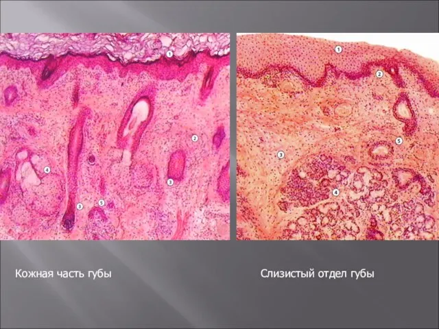 Кожная часть губы Кожная часть губы Слизистый отдел губы