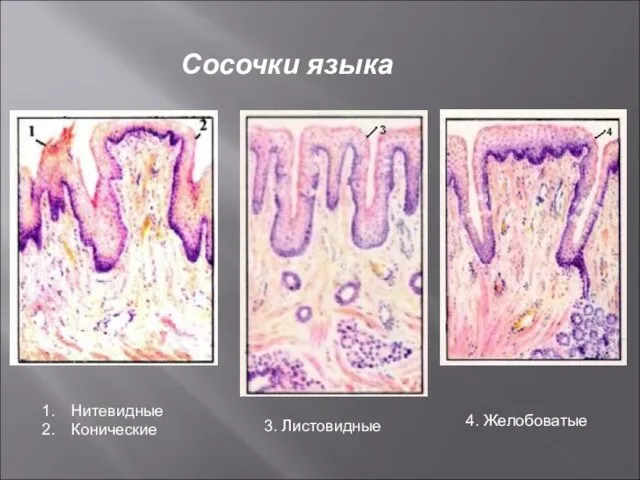 Сосочки языка Нитевидные Конические 3. Листовидные 4. Желобоватые