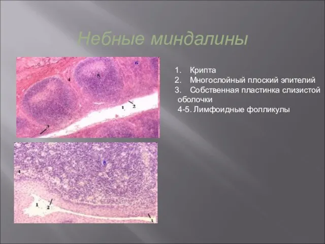 Крипта Многослойный плоский эпителий Собственная пластинка слизистой оболочки 4-5. Лимфоидные фолликулы Небные миндалины