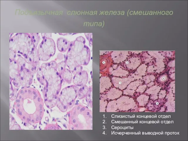 Подъязычная слюнная железа (смешанного типа) Слизистый концевой отдел Смешанный концевой отдел Сероциты Исчерченный выводной проток