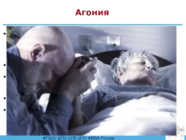 Агония Отсутствие пульса на периферических артериях. Ослаблен пульс на магистральных артериях Отсутствие