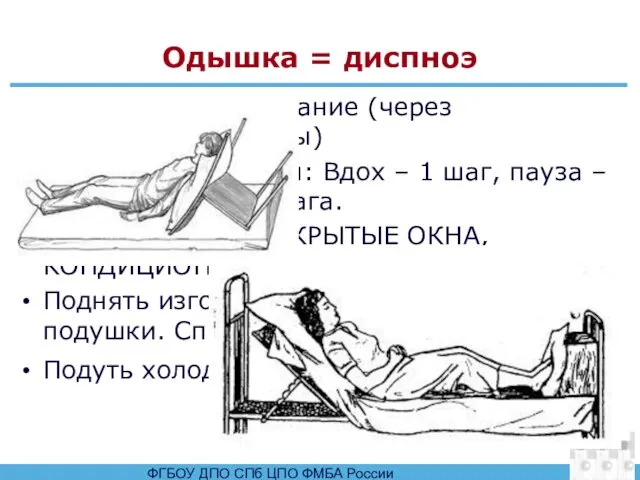 Одышка = диспноэ Поверхностное дыхание (через полусомкнутые губы) Ходьба с дыханием: Вдох