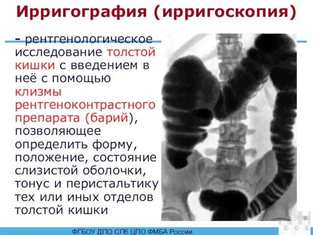 Ирригография (ирригоскопия) - рентгенологическое исследование толстой кишки с введением в неё с