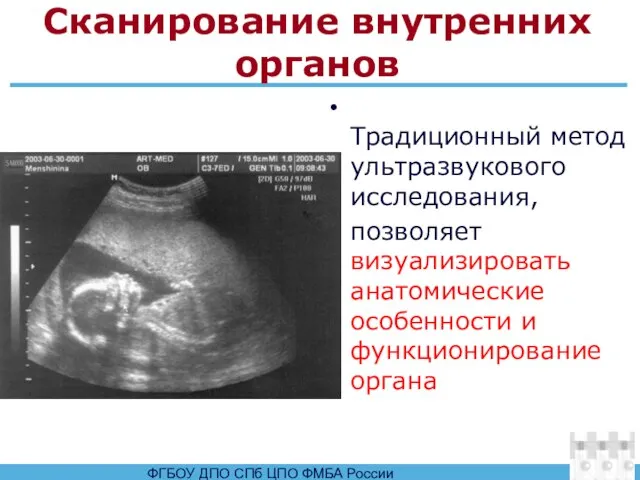 Сканирование внутренних органов Традиционный метод ультразвукового исследования, позволяет визуализировать анатомические особенности и функционирование органа