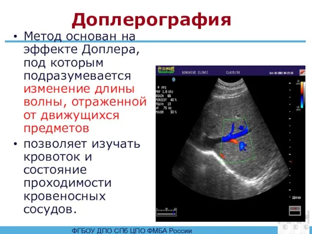 Доплерография Метод основан на эффекте Доплера, под которым подразумевается изменение длины волны,