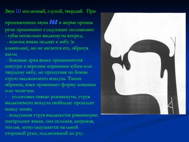 Звук Ш согласный, глухой, твердый. При произнесении звука ш в норме органы