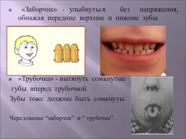 «Заборчик» - улыбнуться без напряжения, обнажая передние верхние и нижние зубы. «Трубочка»