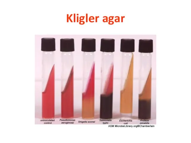 Kligler agar