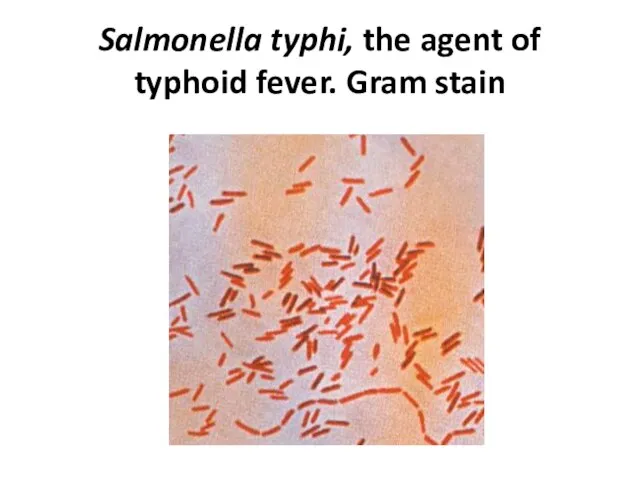 Salmonella typhi, the agent of typhoid fever. Gram stain