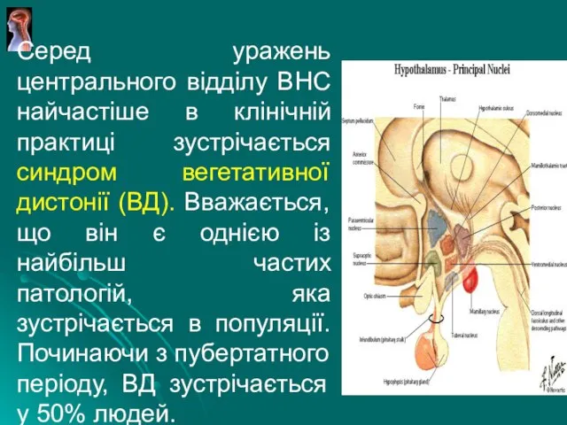 Серед уражень центрального відділу ВНС найчастіше в клінічній практиці зустрічається синдром вегетативної