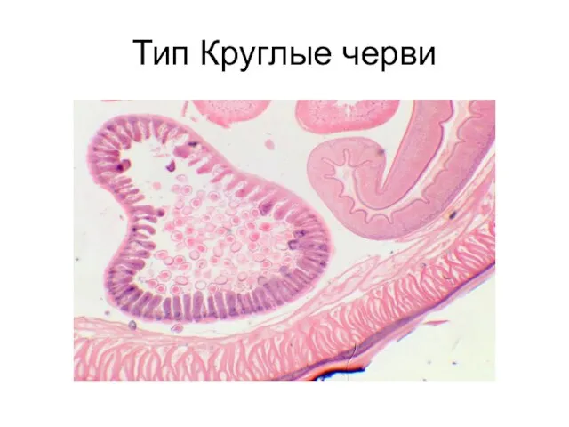 Тип Круглые черви