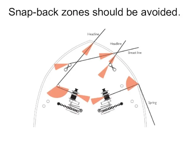 Snap-back zones should be avoided.