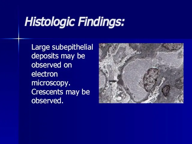 Histologic Findings: Large subepithelial deposits may be observed on electron microscopy. Crescents may be observed.