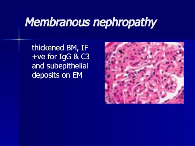 Membranous nephropathy thickened BM, IF +ve for IgG & C3 and subepithelial deposits on EM