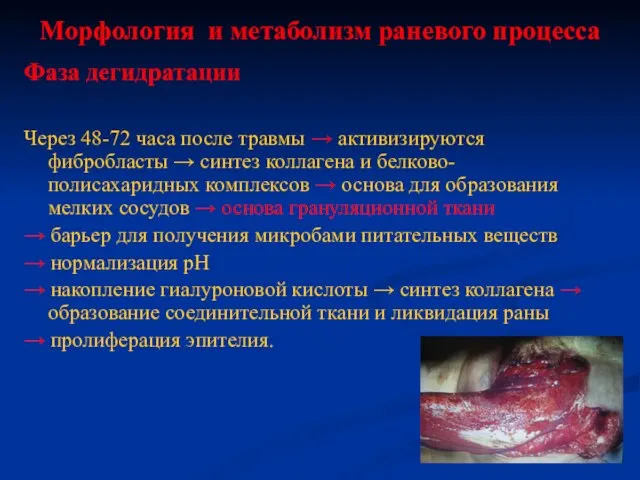 Морфология и метаболизм раневого процесса Через 48-72 часа после травмы → активизируются