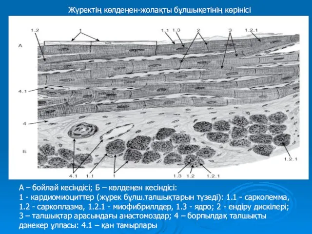 А – бойлай кесіндісі; Б – көлдеңен кесіндісі: 1 - кардиомиоциттер (жұрек
