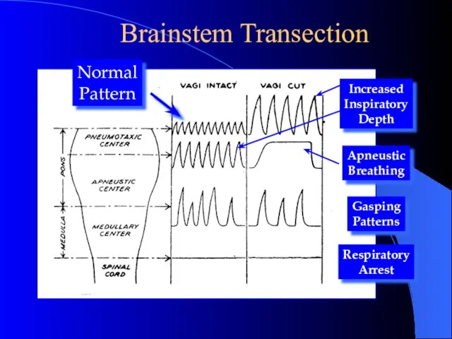 Brainstem Transection