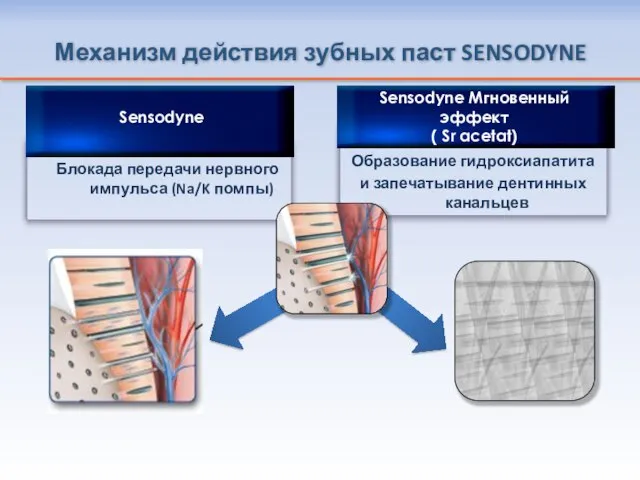 Образование гидроксиапатита и запечатывание дентинных канальцев Механизм действия зубных паст SENSODYNE Блокада