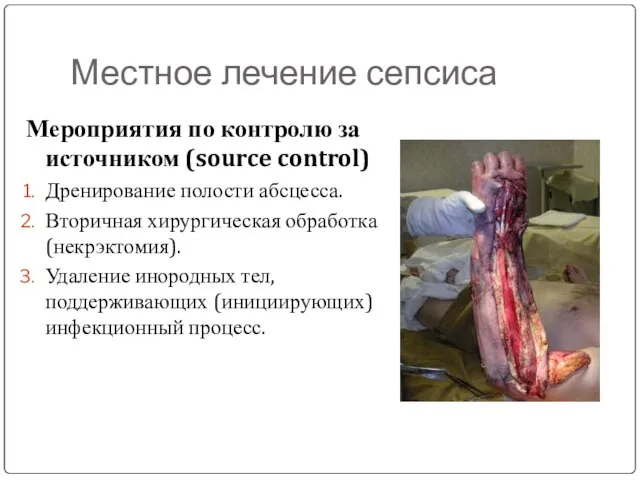 Местное лечение сепсиса Мероприятия по контролю за источником (source control) Дренирование полости