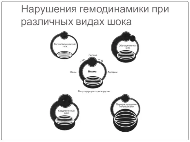 Нарушения гемодинамики при различных видах шока