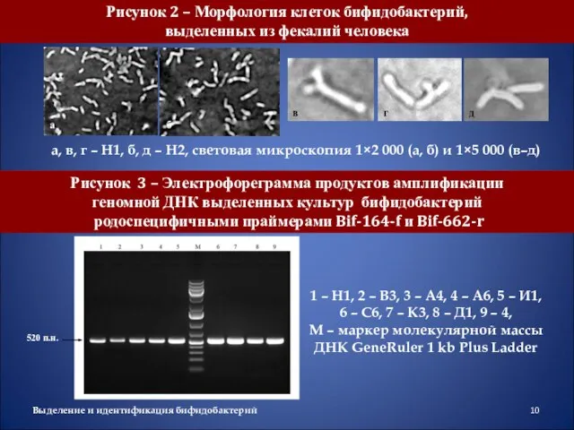 Рисунок 3 – Электрофореграмма продуктов амплификации геномной ДНК выделенных культур бифидобактерий родоспецифичными