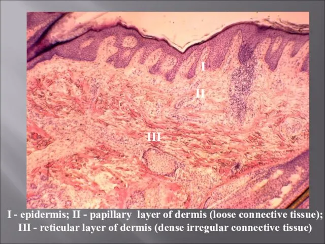 II I III I - epidermis; II - papillary layer of dermis