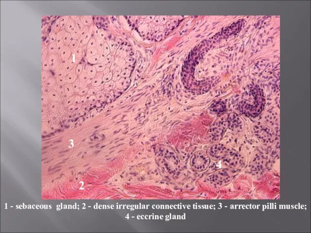 1 - sebaceous gland; 2 - dense irregular connective tissue; 3 -