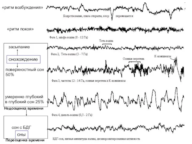 «ритм покоя» «ритм возбуждения» поверхностный сон 50% засыпание умеренно глубокий в глубокий
