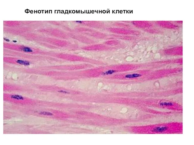Фенотип гладкомышечной клетки