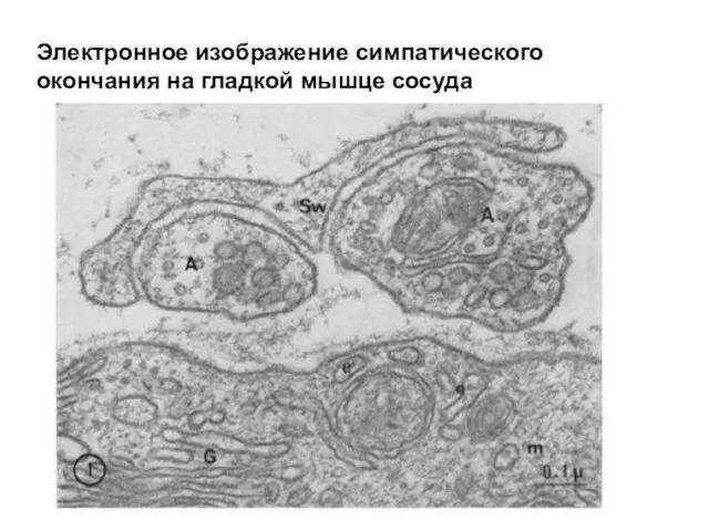 Электронное изображение симпатического окончания на гладкой мышце сосуда