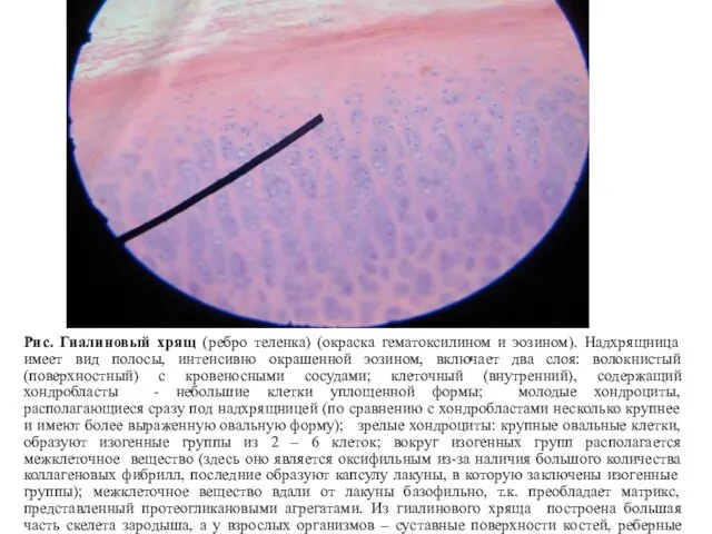 Рис. Гиалиновый хрящ (ребро теленка) (окраска гематоксилином и эозином). Надхрящница имеет вид