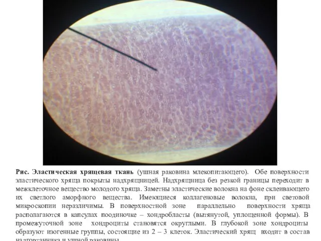Рис. Эластическая хрящевая ткань (ушная раковина млекопитающего). Обе поверхности эластического хряща покрыты