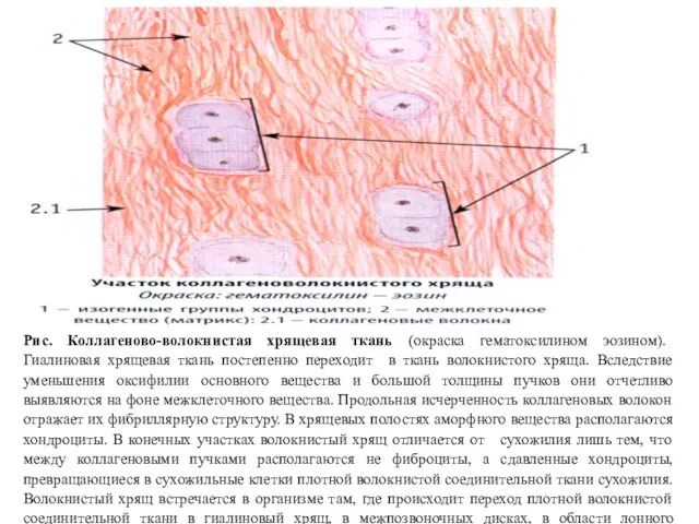 Рис. Коллагеново-волокнистая хрящевая ткань (окраска гематоксилином эозином). Гиалиновая хрящевая ткань постепенно переходит