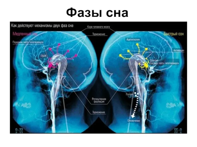 Фазы сна